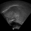 Tongue Tracking In Ultrasound Images With Active Appearance Models